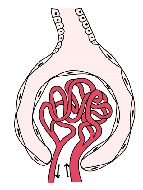 Renal Disorder