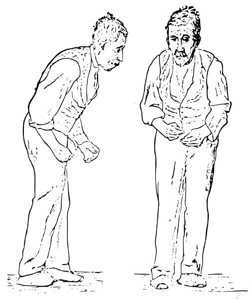 Sir William Richard Gowers Parkinson Disease sketch