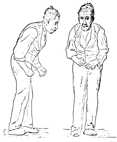 Sir William Richard Gowers Parkinson Disease sketch