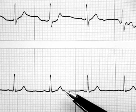 EKG and pen
