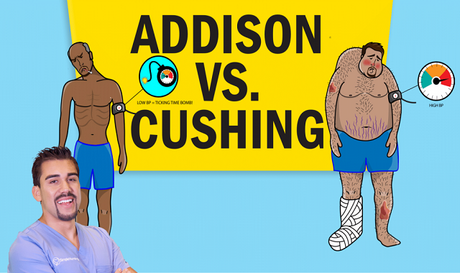 title card for Addison's vs Cushing's Disease