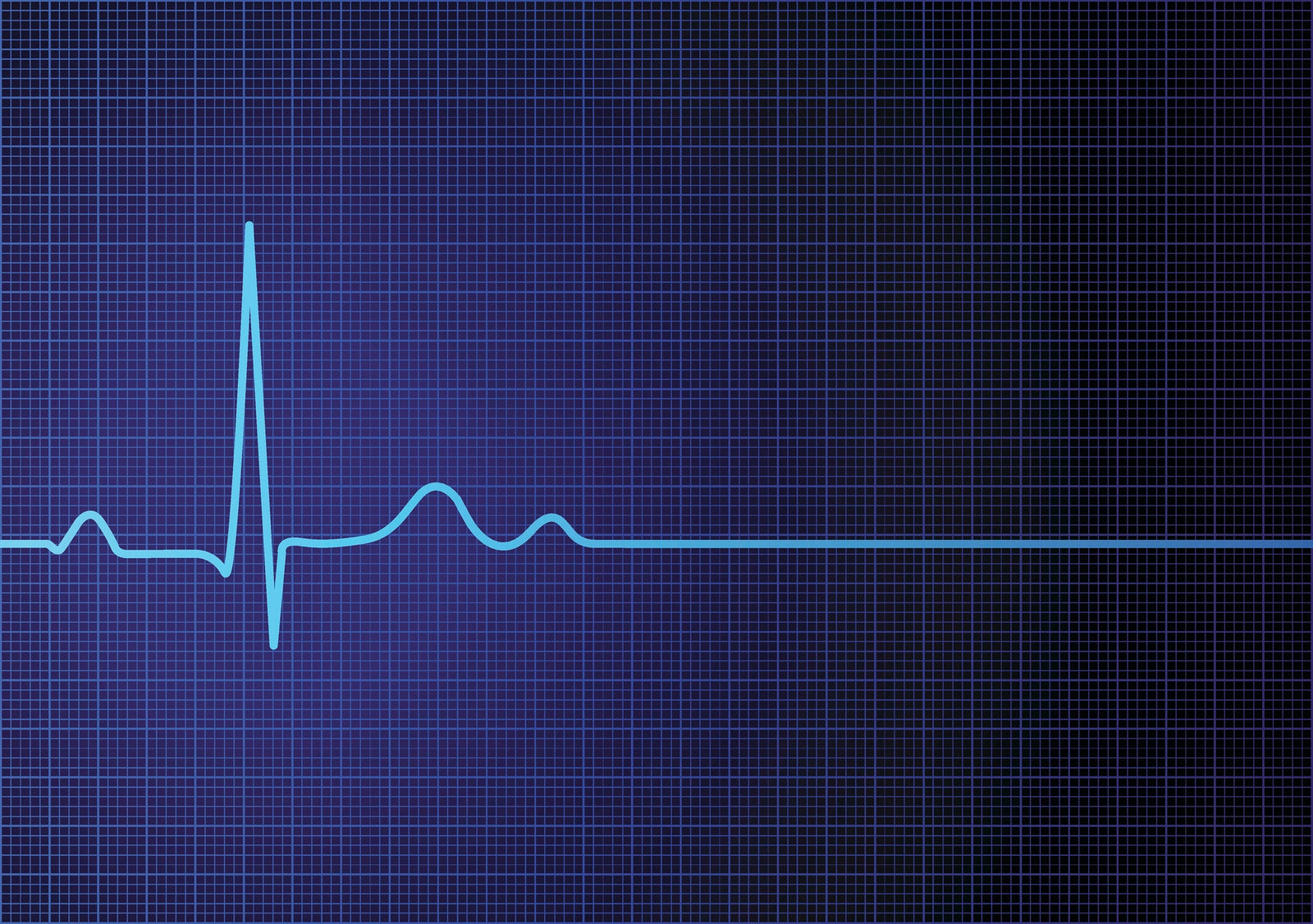 Digital EKG-ECG Wave