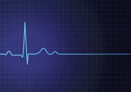 Digital EKG-ECG Wave