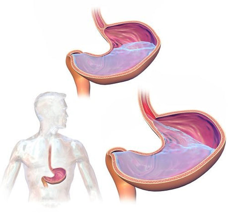 Gastro Esophageal Reflux Disease (GERD)