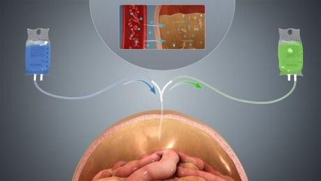 Peritoneal dialysis