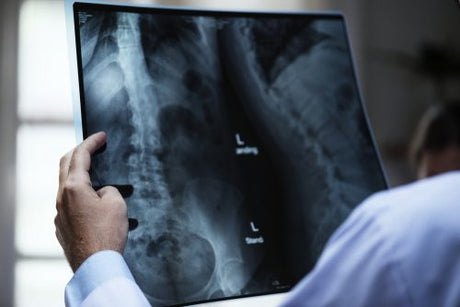 Doctor reviews an X ray