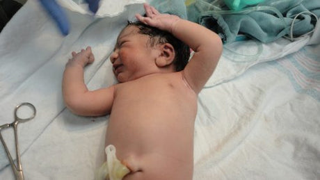 Newborn baby on a table immediately after birth with the umbilical clamp