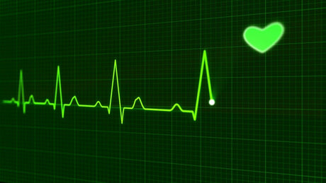 EKG Sinus Heart Rhythm