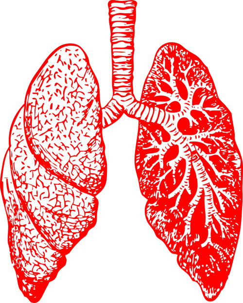 illustration of lungs showing acute respiratory distress syndrome