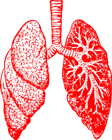 illustration of lungs showing acute respiratory distress syndrome
