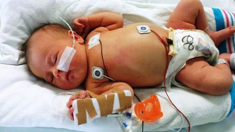 newborn in a NICU in distress and being treated by a NICU nurse