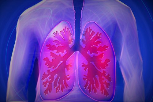 Acute Respiratory Distress Syndrome: Disease Progression