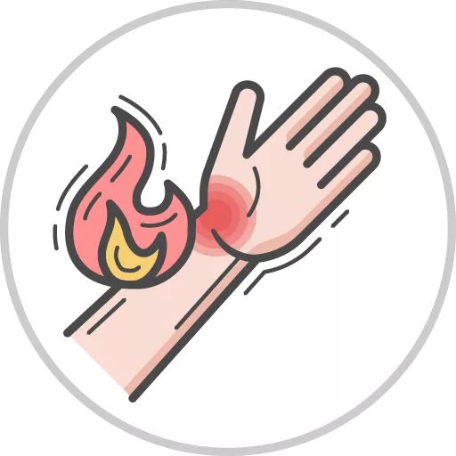 Burns