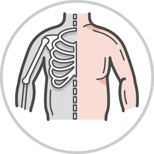 Musculoskeletal (Child Health)