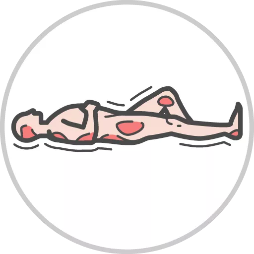 Pressure injuries