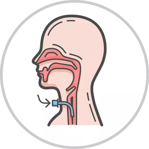 Tracheostomy Care